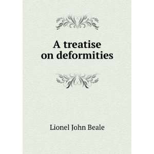 treatise on deformities Lionel John Beale  Books