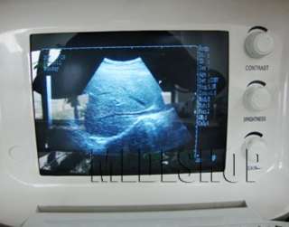   Digital Ultrasound Machine/Scanner Convex Probe with 3D Workstation