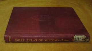 AN X RAY ATLAS OF SILICOSIS Asbestosis Asbestos Lungs Medicine 1941 