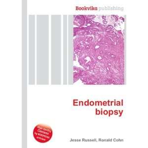  Endometrial biopsy Ronald Cohn Jesse Russell Books