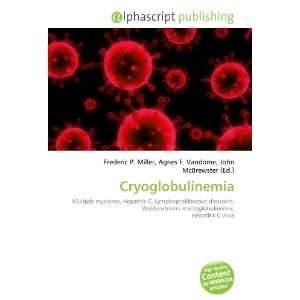  Cryoglobulinemia (9786134010221) Books