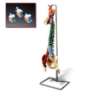   Vertebral Column with Disorders with Stand