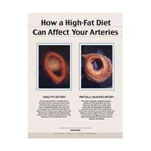 How a High Fat Diet Affects Your Arteries Chart  