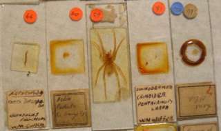 15 Vintage Prepared BIOLOGY MICROSCOPE SLIDES  